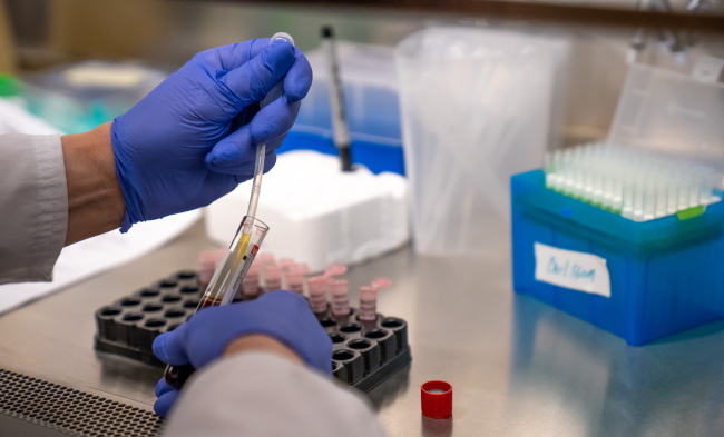 Alzheimer's disease research